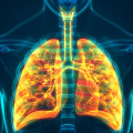 Understanding Respiratory Infections: The Hidden Dangers of Radon Exposure
