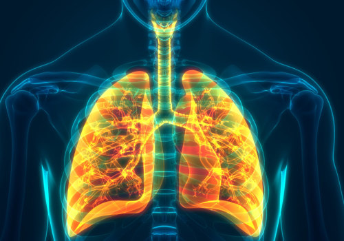 Preventing Radon-Induced Lung Cancer: A Comprehensive Guide
