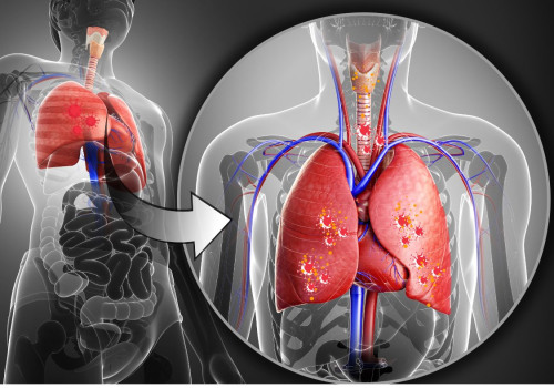 The Hidden Link Between Radon Exposure and Cardiovascular Problems