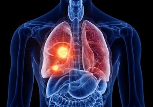 The Hidden Dangers of Radon Exposure: Beyond Lung Cancer